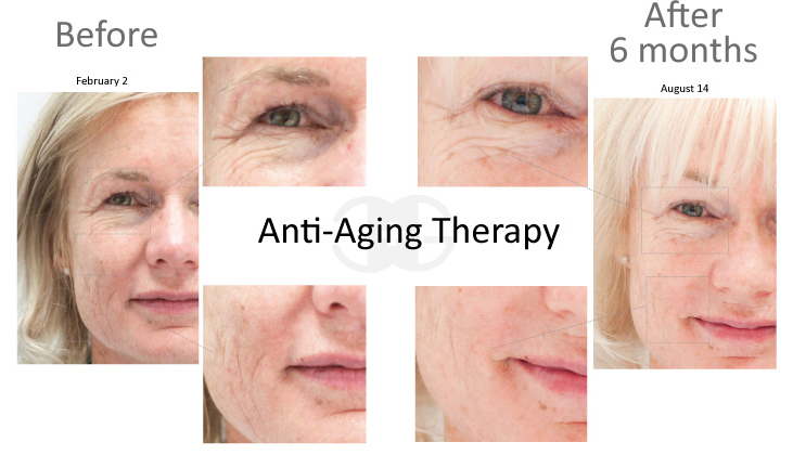 antiaging
