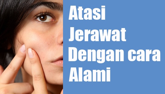 menghilangkan jerawat dengan cara alami