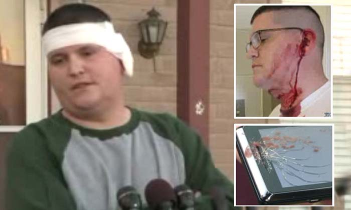 Insiden ponsel meledak