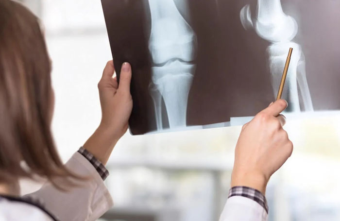 proses regenasi tulang